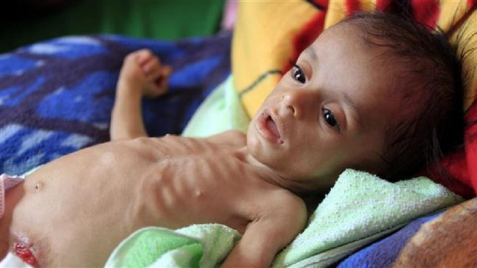 UNİCEF'ten Yemen için kapsamlı barış anlaşması çağrısı