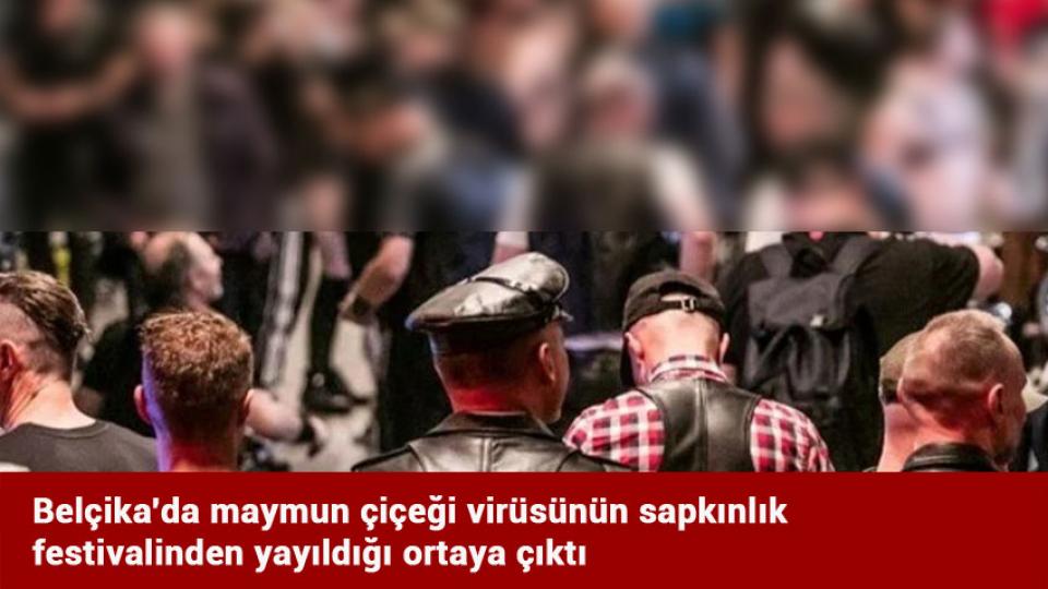 Belçika'da maymun çiçeği virüsünün sapkınlık festivalinden yayıldığı ortaya çıktı