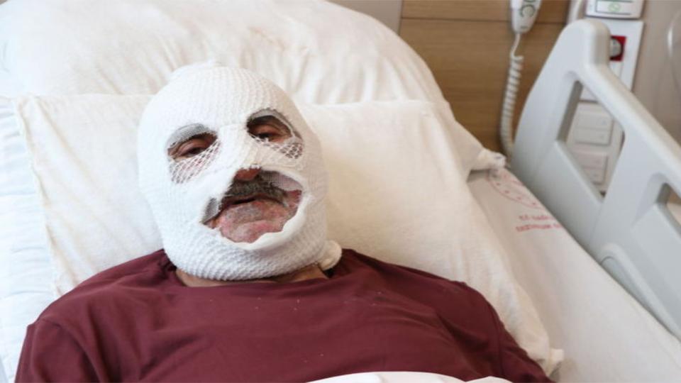 "Güm diye bir parlama oldu!" Çakmakla tüpü kontrol etti!