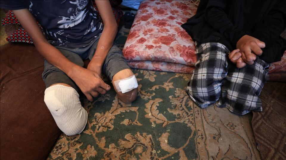 Her Taraf - Türkiyenin habercisi / Filistin Sağlık Bakanlığı: Gazze nüfusa oranla dünyada en fazla ampute çocuk sayısına sahip
